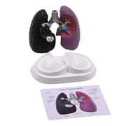 Pathological Lung Anatomy Model Human Anatomical Lung Model Classroom Teaching Tool for Clinical Setting Educational Use Classroom Lung Model