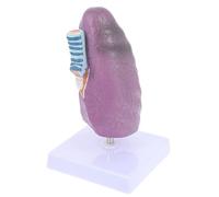 Pathological Lung Model Smokers Lungs with Palpable Tumors, 2/3 Life Size Human Lung Teaching for Anti-Smoking Education Human Torso Model
