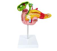 Pathological Model of Pancreas, Duodenum and Gallbladder, Human Model Digestive System, for Teaching and Demonstrating A