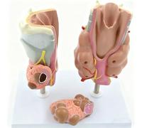 Pathological Thyroid Anatomy Model, Realistic Human Thyroid Pathology Model with Throat Tumor&Cyst, Anatomical Teaching Aid for Classroom Demonstration