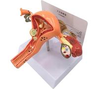 Pathological Uterine Reproductive Model Female Pathological Uterus Teaching Model Ovarian Anatomy Model Female Genitalia Model for Doctors Study Uterus and Ovaries Diseases