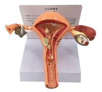 Pathological Uterus Model - Female Reproductive System Anatomical Model, Uterus Ovarian Anatomy Model - for Human Anatomy and Physiology Education Female Internal Reproductive Organs Model