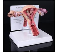Pathological Uterus Ovary Model, Female Reproductive Organ Model Human Uterus Anatomical Model with Educational Display Card and Base for School Teaching