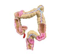 Pathology Anatomy Teaching Model, Pathological Large i