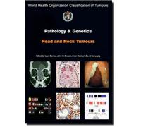 Pathology and Genetics of Head and Neck Tumours (IARC WHO Classification of Tumours) 1st edition by The International Agency for Research on Cancer (2005) Paperback