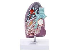 Pathology Lung Model,3D Human Lung Anatomical Model with Accurate Anatomy Structure for Teaching Models Doctor-Patient Communication