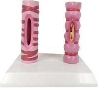 Pathology Lung Tube Trachea Comparison Mode, Organ Anatomy Respiratory System Structure, Human Healthy Trachea and Pathological Comparison Model, for Medical Teaching Study