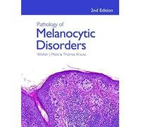 Pathology of Melanocytic Disorders 2ed