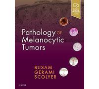 Pathology of Melanocytic Tumors