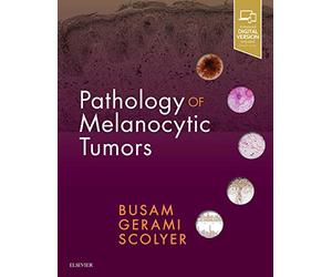 Pathology of Melanocytic Tumors