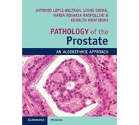 Pathology of the Prostate: An Algorithmic Approach