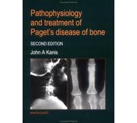 Pathophysiology and Treatment of Paget's Disease of Bone