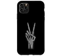 Peace Sign Skeleton Hand Funny Radiology Tech Case for iPhone 11 Pro Max