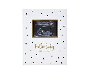 Pearhead First 5 Years Baby Memory Book with Sonogram Photo Insert, Black and Gold Polka Dot, Baby Keepsake Memory Book, Hello Baby Babybook