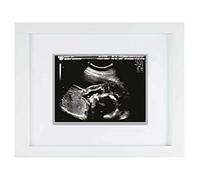 Pearhead Sonogram Keepsake Frame, Mothering Sunday Mother's Day Expecting or New Mum Gift, White