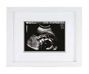 Pearhead Sonogram Keepsake Frame, Mothering Sunday Mother's Day Expecting or New Mum Gift, White