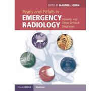 Pearls and Pitfalls in Emergency Radiology: Variants and Other Difficult Diagnoses