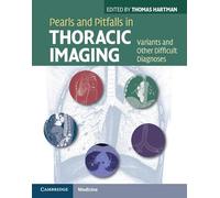 Pearls and Pitfalls in Thoracic Imaging: Variants and Other Difficult Diagnoses