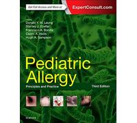 Pediatric Allergy: Principles and Practice