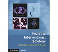Pediatric Interventional Radiology