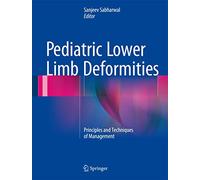 Pediatric Lower Limb Deformities: Principles and Techniques of Management