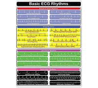 peiyeety Knowledge Aluminum Sign Basic Ecg Rhythms Chart Metal Tin Signs Vintage Cardiology Knowledge Retro Posters Plaques for Home Room Clinic Wall Decor 8" x 12"