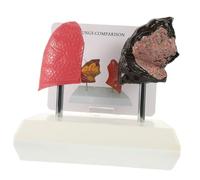 PEPLAYTAL Smoking Lung Anatomy Model Human Educational Tool for Medical Teaching Anatomical Display for Physiology and Pathology Studies