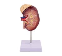 Perfeclan Human Kidney Model Professional Dissection Model Teaching Tool for Classroom Science Demonstration