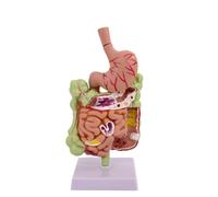 perfeclan Intestine Spec Gastrointestinal Model Stomach Colon Rectum Duodenum With Removable And Pathology Highlights in PVC suitable for classroom teaching medical training display 26cm