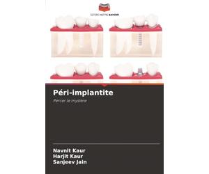 Péri-implantite: Percer le mystère