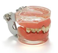Periodontal Disease Teeth Model, Anatomical Teaching Model with Soft Gum and Removable Teeth for Education and Demonstrations, Ideal for Dental Training