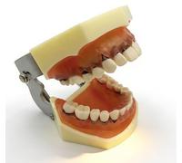 Periodontal Disease Teeth Model, Anatomical Teaching Model with Soft Gum and Removable Teeth for Education and Demonstrations, Ideal for Dental Training