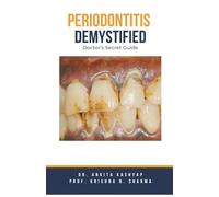 Periodontitis Demystified: Doctor's Secret Guide