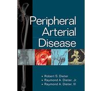Peripheral Arterial Disease (INTERNAL MEDICINE)