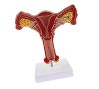 Persistence 1:1 Human Female Uterus Ovary Fallopian Tubes Model Anatomical Human Anatomy Model Teaching Tools