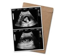 Personalized Fake Pregnancy Ultrasound, Realistic Fake Sonogram Print for Pregnancy Prank, Custom Ultrasound Picture Gift, Twins Ultrasound Reveal, Funny Pregnancy Announcement Photo