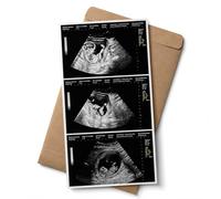 Personalized Fake Ultrasound Prank Photo, Realistic Pregnancy Sonogram Picture for Funny Pregnancy Reveal, Custom Twins Ultrasound Print, Fake Pregnancy Scan Gift 4-30 Weeks