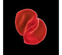 Peter Gabriel - Scratch My Back