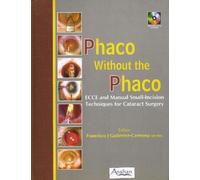 Phaco Without the Phaco: ECCE and Manual Small-Incision Techniques for Cataract Surgery