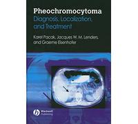 Pheochromocytoma: Diagnosis, Localization, and Treatment