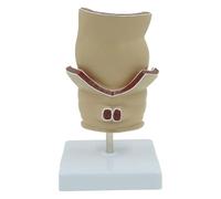 Physiological Rectal Pathology Teaching Simulation Model Rectum Model Human Rectal Ulcer Acne Pathological Model Hemorrhoids Model for Anorectal Disease Demonstration