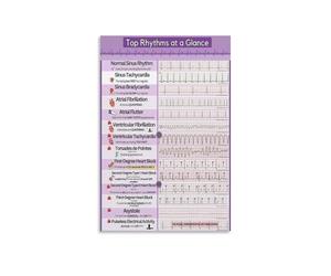 PKNVKZIDK Cardiology Knowledge Metal Sign EKG ECG Rhythms Reference Chart for Student Study Room and Classroom Wall-Art (8 X 12 in)