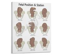 PKNVKZIDK Student Resource Fetal Position Station Chart Childbirth Education Poster Canvas Wall-Art for Skills Unframed,16x24inch(40x60cm)