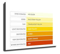 PKNVKZIDK Understanding Urine Color Chart Poster Wall-Art for Health Office Decor Unframed,08x12inch(20x30cm)