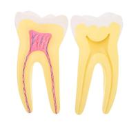 POPETPOP Molar Anatomical Model for Dentist Teaching, Plastic Simulation Tooth Model for Education and Clinical Demonstration