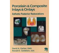 Porcelain and Composite Inlays and Onlays: Aesthetic Posterior Restorations