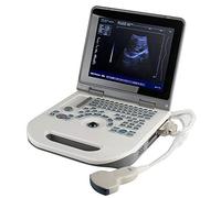 Portable Digital Laptop Scanner with 12.1 Inch LED Screen, Multi-Frequency Convex Technology, Battery Included