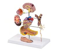 Portable Human Anatomy Model Illustrating Diabete and Hypertensions Effects on Body Organs Hyperglycemia Complications Model