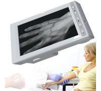 Portable Infrared Vein Finder Device, Enhances Efficiency for Various Skin Types in Medical and Clinical Use