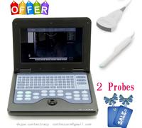Portable laptop machine Digital Ultrasound Scanner 3.5M Convex,6.5M transvaginal